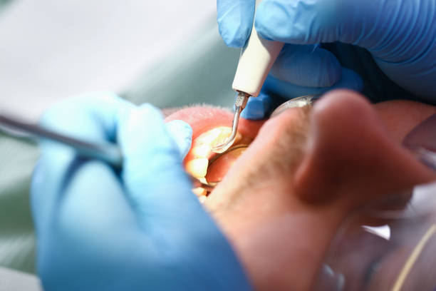 Best Same-Day Emergency Dentist in Mcalester, OK